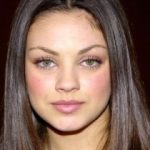Mila Kunis Plastic Surgery Before and After