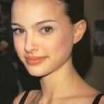 Natalie Portman Plastic Surgery Before and After