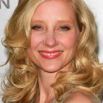 Anne Heche Plastic Surgery Before and After