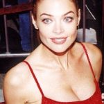 Denise Richards Plastic Surgery Before and After