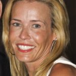 Chelsea Handler Plastic Surgery Before and After