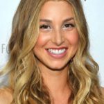 Whitney Port Plastic Surgery Before and After