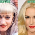 Gwen Stefani Plastic Surgery Before and After