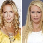 Anna Camp Plastic Surgery Before and After