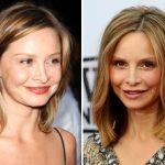 Calista Flockhart Plastic Surgery Before and After