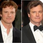 Colin Firth Plastic Surgery Before and After