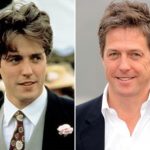 Hugh Grant Plastic Surgery Before and After
