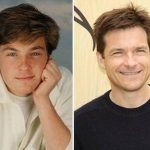 Jason Bateman Plastic Surgery Before and After