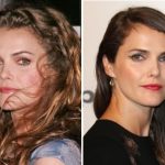 Keri Russell Plastic Surgery Before and After