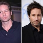 David Duchovny Plastic Surgery Before and After