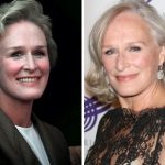 Glenn Close Plastic Surgery Before and After