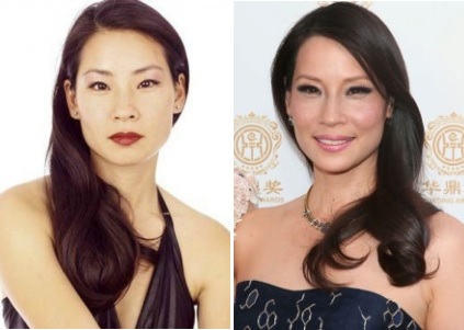 Has Lucy Liu had Plastic Surgery? 