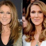 Celine Dion Plastic Surgery Before and After