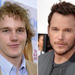 Chris Pratt Plastic Surgery Before and After