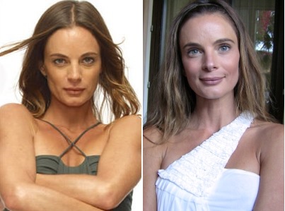 Gabrielle Anwar Plastic Surgery Before And After Celebrity Surgeries