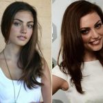 Phoebe Tonkin Plastic Surgery Before and After
