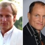 Woody Harrelson Plastic Surgery Before and After