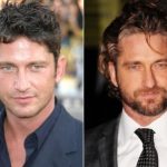 Gerard Butler Plastic Surgery Before and After