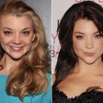 Natalie Dormer Plastic Surgery Before and After