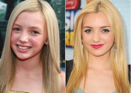 Peyton List Plastic Surgery Before and After - Celebrity Surgeries.