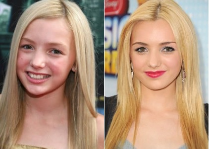 Has Peyton List had Plastic Surgery? 