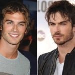 Ian Somerhalder Plastic Surgery Before and After