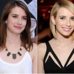 Emma Roberts Plastic Surgery Before and After