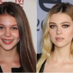 Nicola Peltz Plastic Surgery Before and After