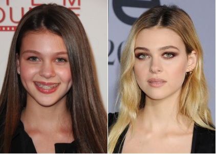 Has Nicola Peltz had Plastic Surgery? 