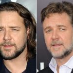 Russell Crowe Plastic Surgery Before and After