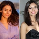 Victoria Justice Plastic Surgery Before and After
