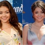 Sarah Hyland Plastic Surgery Before and After
