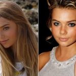 Indiana Evans Plastic Surgery Before and After