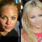 Laura Vandervoort Plastic Surgery Before and After