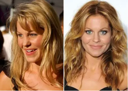 Candace Cameron Plastic Surgery Before and After - Celebrity Surgeries