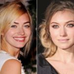 Imogen Poots Plastic Surgery Before and After