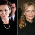 Joan Allen Plastic Surgery Before and After