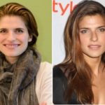 Lake Bell Plastic Surgery Before and After