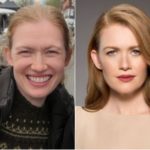 Mireille Enos Plastic Surgery Before and After