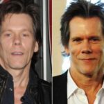Kevin Bacon Plastic Surgery Before and After