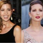 Ivanka Trump Plastic Surgery Before and After