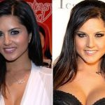 Sunny Leone Plastic Surgery Before and After