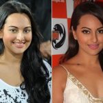 Sonakshi Sinha Plastic Surgery Before and After