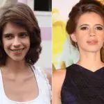 Kalki Koechlin Plastic Surgery Before and After
