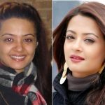 Surveen Chawla Plastic Surgery Before and After