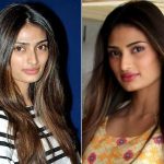 Athiya Shetty Plastic Surgery Before and After