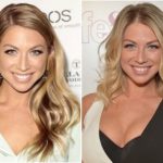 Stassi Schroeder Plastic Surgery Before and After