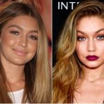 Gigi Hadid Plastic Surgery Before and After