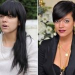 Lily Allen Plastic Surgery Before and After