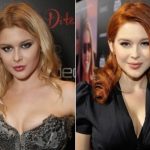 Renee Olstead Plastic Surgery Before and After